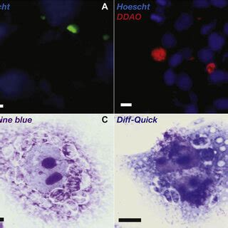  Neospora!  A Microscopic Menace That Lurks Everywhere, Infecting Mammals with Its Devious Strategies