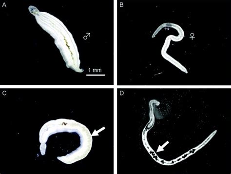 Schistosoma mansoni: Uma Verme Inconspícua Que Deixa uma Marca Persistente!